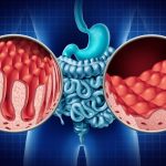 BUĞDAY/GLÜTEN ZARARLI MI? ÇÖLYAK HASTALIĞI (Celiac Disease) NEDİR?